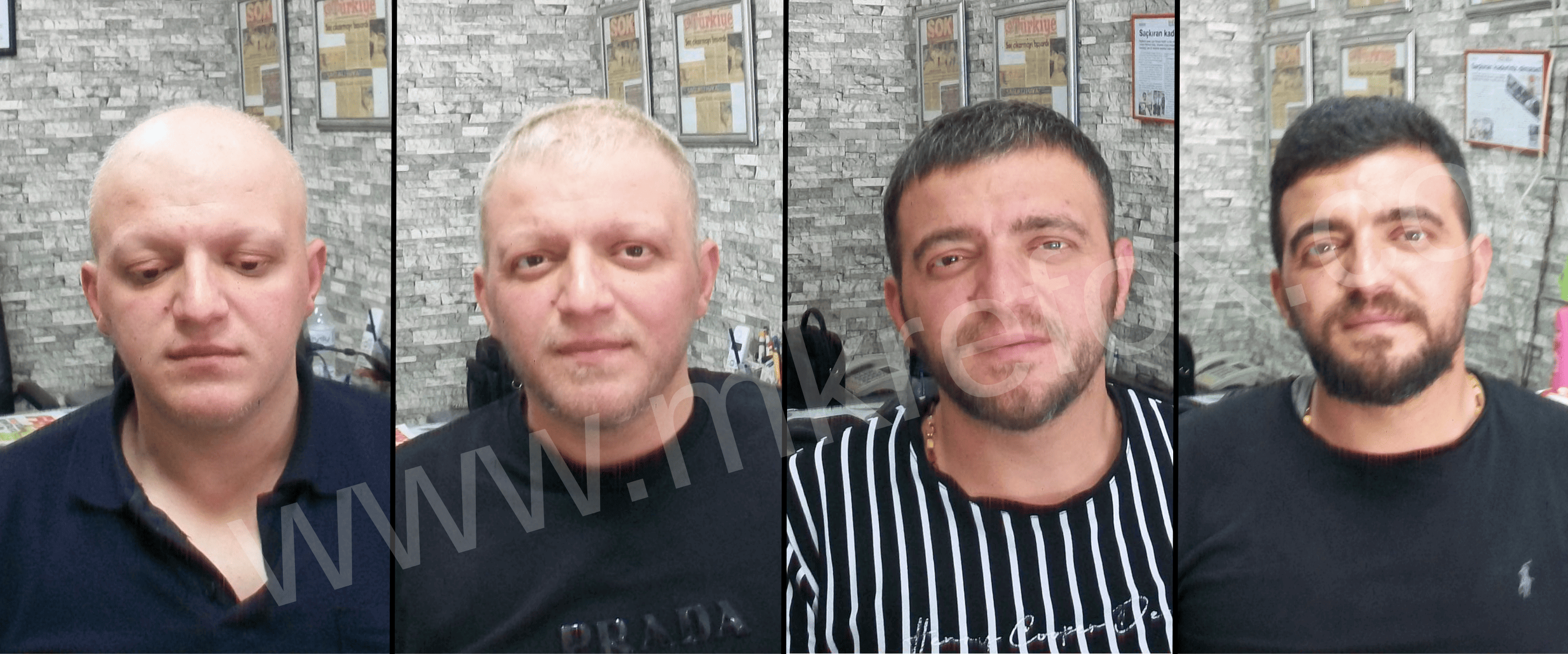 Alopesi Areata Konya Kliniği